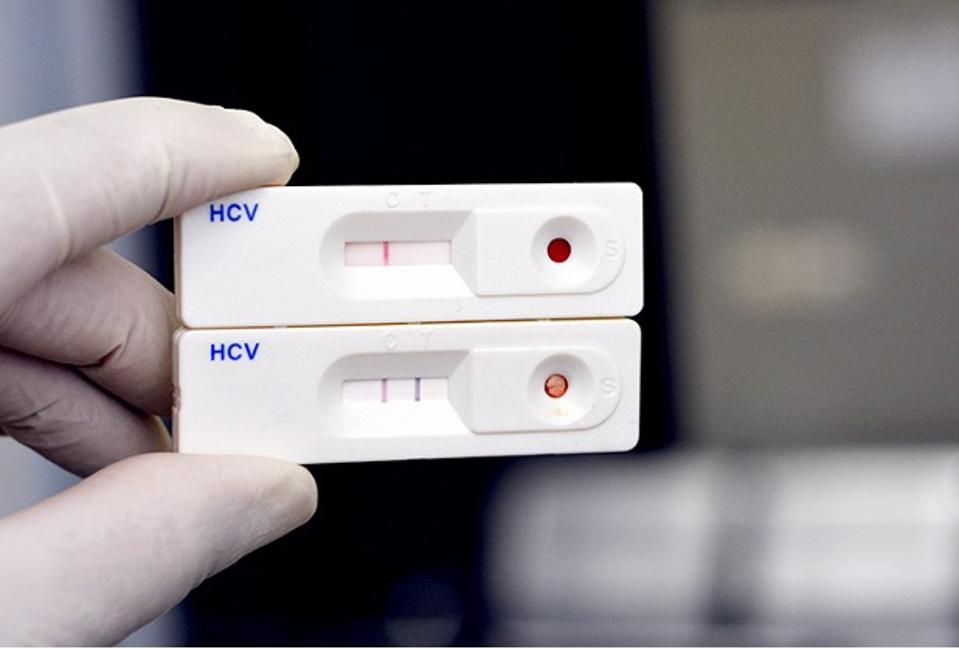 positive and negative hcv antibody test