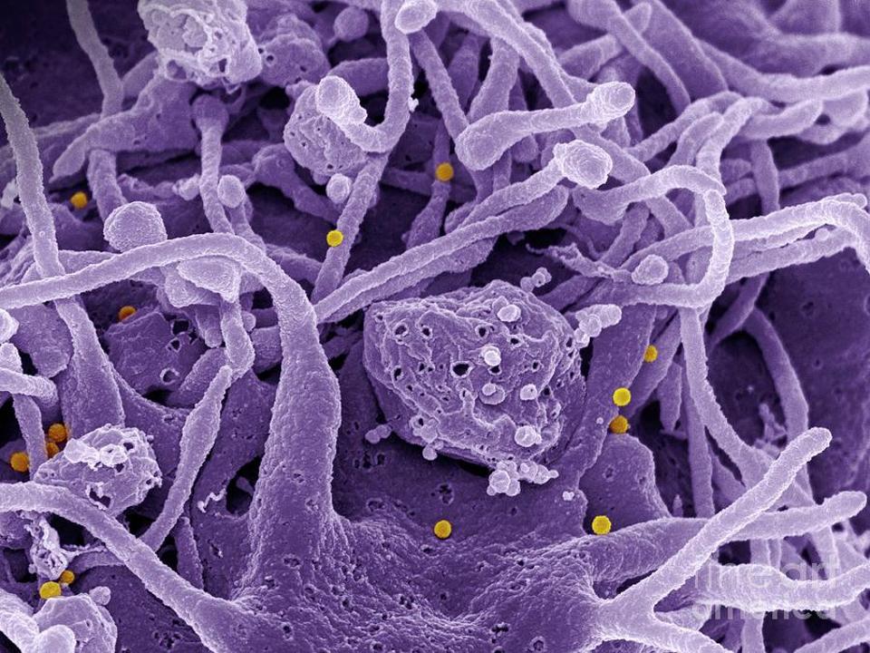 CCHF particles colored SEM image