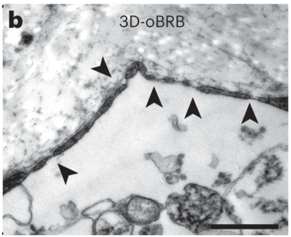 Figure 2: Microscopic images of the model blood vessels display thinned areas in the capillary, indicating the presence of capillary fenestrations (marked by arrows).