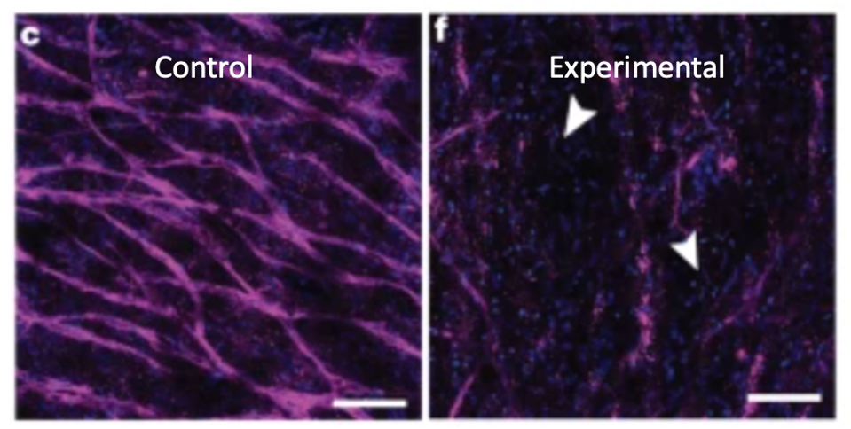 Figure 4: Treatment of the model retinal pigment epithelial with lipid-protein serum resulted in significant degradation of the retinal pigment epithelial cells and vasculature.