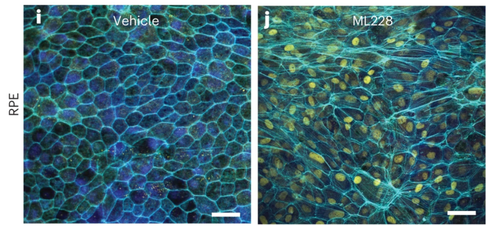 Figure 5: Treatment with ML228 resulted in an overgrowth of blood vessels, a biological symptom found in wet age-related macular degeneration.