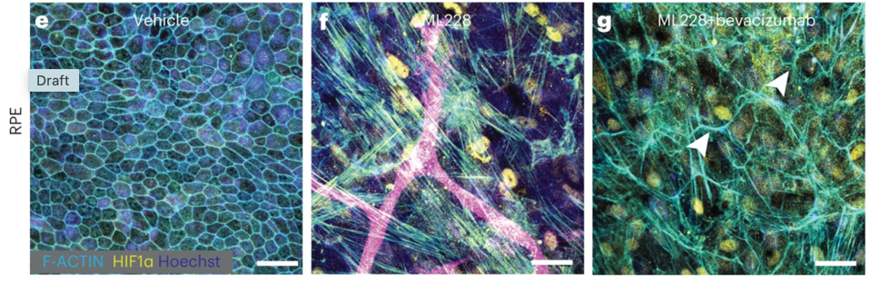 Figure 6: Bevacizumab was able to reverse the overgrowth growth of blood vessels caused by ML228 treatment.