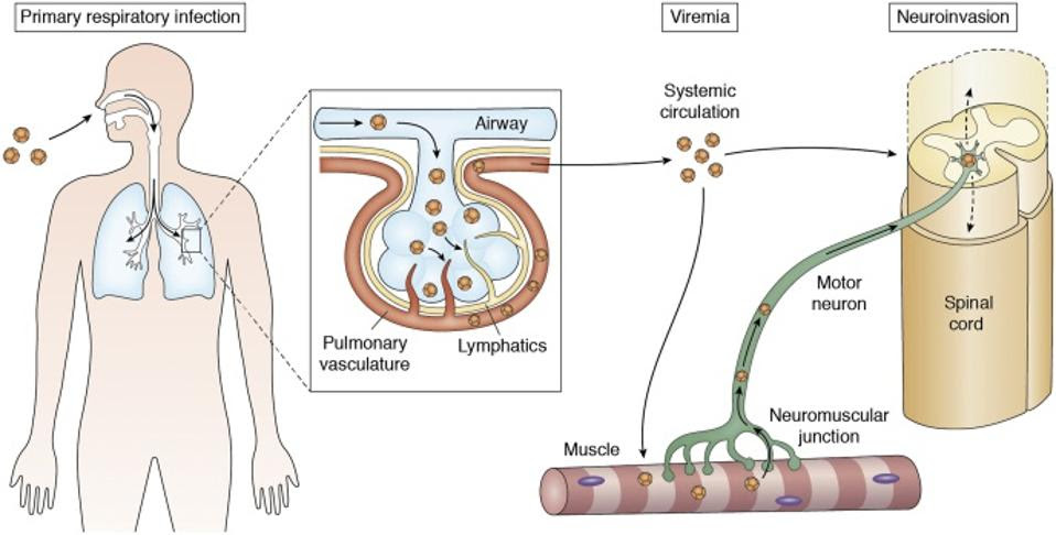 EV-D68 hypothesized mechanisms of neuroinvasion