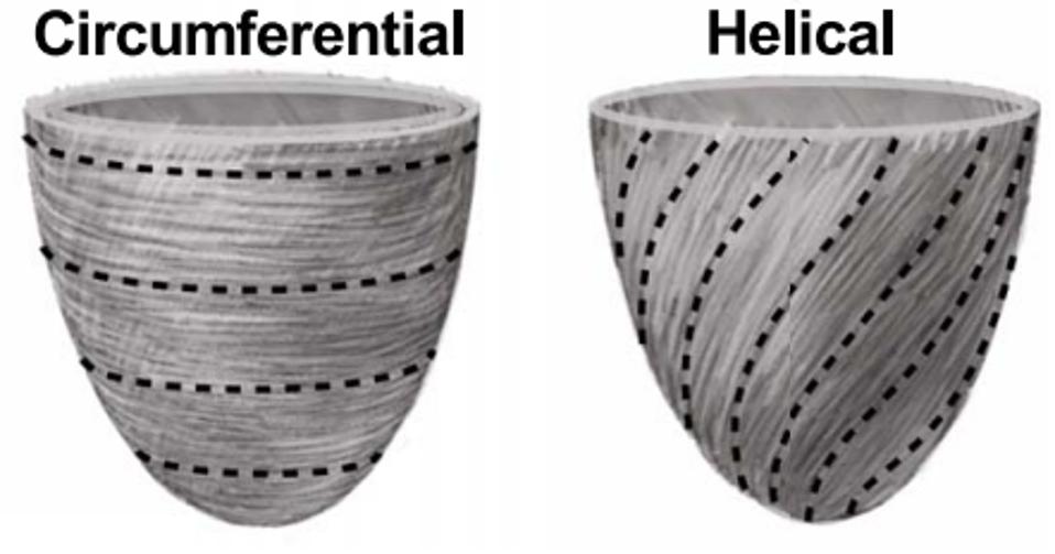 Figure 4: Chang et al. created model ventricles with helically aligned cells and circumferentially aligned cells.