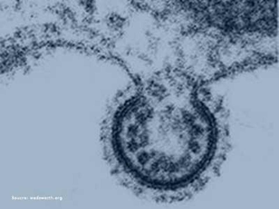 RSV electron microscopy image
