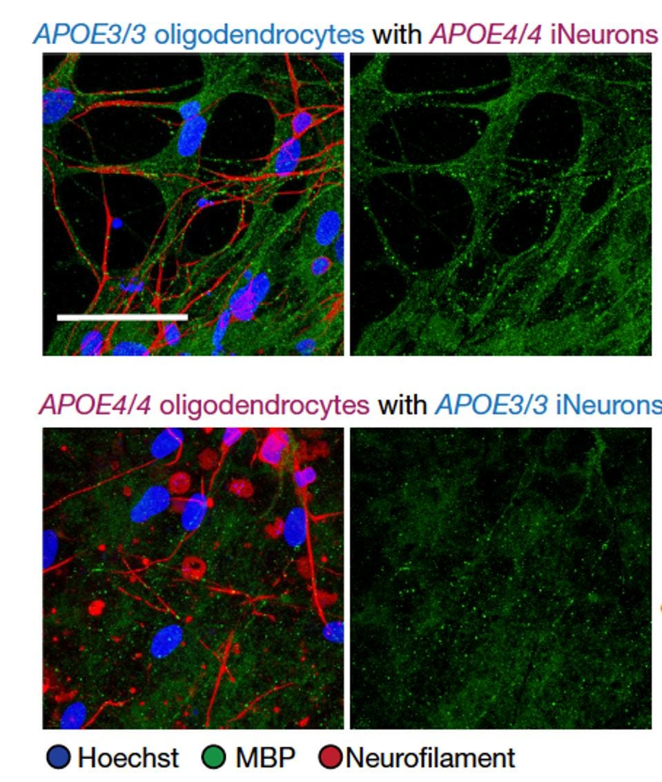 Figure 3: E3/E3 oligodendrocytes produced structured myelin in the presence of E4/E4 neurons (top row). E4/E4 oligodendrocytes did not produce regular, structured myelin even in the presence of E3/E3 neurons (bottom row)